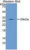 Thyroid Hormone Receptor Beta antibody, MBS2025864, MyBioSource, Western Blot image 