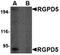 RANBP2 Like And GRIP Domain Containing 6 antibody, orb74981, Biorbyt, Western Blot image 