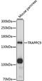 Trafficking Protein Particle Complex 9 antibody, 16-091, ProSci, Western Blot image 