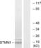 Stathmin 1 antibody, LS-B12435, Lifespan Biosciences, Western Blot image 