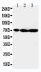 Mitogen-Activated Protein Kinase Kinase Kinase 2 antibody, GTX11792, GeneTex, Western Blot image 