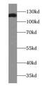 Integrin Subunit Alpha 3 antibody, FNab04344, FineTest, Western Blot image 