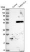 Transmembrane Protein 151A antibody, NBP1-81115, Novus Biologicals, Western Blot image 