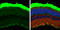 Rhodopsin antibody, GTX129910, GeneTex, Immunohistochemistry paraffin image 