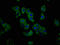 Glycoprotein-N-acetylgalactosamine 3-beta-galactosyltransferase 1 antibody, LS-C673963, Lifespan Biosciences, Immunofluorescence image 