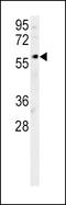 DNA Cross-Link Repair 1B antibody, LS-C167295, Lifespan Biosciences, Western Blot image 