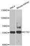 ETS Proto-Oncogene 2, Transcription Factor antibody, STJ23581, St John