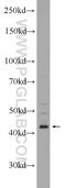 ST8 Alpha-N-Acetyl-Neuraminide Alpha-2,8-Sialyltransferase 1 antibody, 24918-1-AP, Proteintech Group, Western Blot image 