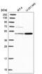 Histidine Ammonia-Lyase antibody, HPA038548, Atlas Antibodies, Western Blot image 