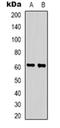 Zinc Finger Protein 397 antibody, orb318947, Biorbyt, Western Blot image 