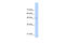 Toll Like Receptor 6 antibody, 27-403, ProSci, Western Blot image 