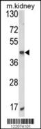 AlkB Homolog 3, Alpha-Ketoglutaratedependent Dioxygenase antibody, 63-586, ProSci, Western Blot image 