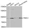 Transient Receptor Potential Cation Channel Subfamily C Member 1 antibody, A01492, Boster Biological Technology, Western Blot image 