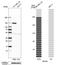 Melanoma Cell Adhesion Molecule antibody, HPA008848, Atlas Antibodies, Western Blot image 