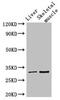 Radial Spoke Head 9 Homolog antibody, CSB-PA867129LA01HU, Cusabio, Western Blot image 