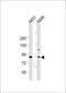 DNA Methyltransferase 3 Beta antibody, 55-145, ProSci, Western Blot image 