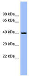 Carcinoembryonic Antigen Related Cell Adhesion Molecule 6 antibody, TA346089, Origene, Western Blot image 
