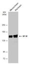 Neurofilament Medium antibody, GTX634483, GeneTex, Western Blot image 