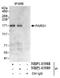 Rho GTPase Activating Protein 29 antibody, NBP1-05988, Novus Biologicals, Western Blot image 