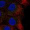 Carbohydrate Sulfotransferase 14 antibody, HPA057697, Atlas Antibodies, Immunofluorescence image 
