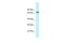 Beta-Transducin Repeat Containing E3 Ubiquitin Protein Ligase antibody, PA5-69160, Invitrogen Antibodies, Western Blot image 