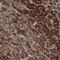 Coiled-Coil Serine Rich Protein 2 antibody, NBP1-81438, Novus Biologicals, Immunohistochemistry paraffin image 