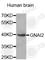 G Protein Subunit Alpha I2 antibody, A3888, ABclonal Technology, Western Blot image 