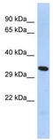 Forkhead Box K2 antibody, TA345614, Origene, Western Blot image 