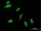 Heart- and neural crest derivatives-expressed protein 2 antibody, H00009464-M05, Novus Biologicals, Immunocytochemistry image 