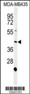 NADPH Oxidase Activator 1 antibody, 64-008, ProSci, Western Blot image 