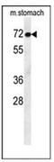 Activating Transcription Factor 7 Interacting Protein 2 antibody, AP52629PU-N, Origene, Western Blot image 