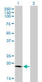 Signal Sequence Receptor Subunit 4 antibody, LS-C198267, Lifespan Biosciences, Western Blot image 