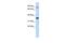 Ring Finger Protein 207 antibody, GTX46875, GeneTex, Western Blot image 