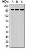 Bamacan antibody, LS-C354391, Lifespan Biosciences, Western Blot image 