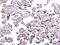 T-Complex 1 antibody, M02389, Boster Biological Technology, Immunohistochemistry paraffin image 