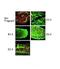 Porcupine O-Acyltransferase antibody, NBP1-59677, Novus Biologicals, Immunohistochemistry paraffin image 