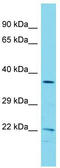 Coatomer Protein Complex Subunit Zeta 1 antibody, TA335570, Origene, Western Blot image 