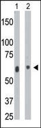 Ceramide Kinase antibody, 62-651, ProSci, Western Blot image 