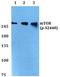 Mechanistic Target Of Rapamycin Kinase antibody, A00003S2448, Boster Biological Technology, Western Blot image 