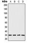 Calcium Binding Tyrosine Phosphorylation Regulated antibody, MBS821971, MyBioSource, Western Blot image 