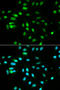Paired Box 3 antibody, STJ24909, St John