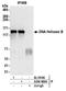 DNA Helicase B antibody, A304-686A, Bethyl Labs, Immunoprecipitation image 