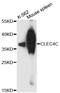 C-Type Lectin Domain Family 4 Member C antibody, LS-C748735, Lifespan Biosciences, Western Blot image 