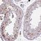 ETS domain-containing protein Elk-1 antibody, NBP2-38278, Novus Biologicals, Immunohistochemistry frozen image 