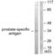 Kallikrein Related Peptidase 3 antibody, abx013184, Abbexa, Western Blot image 