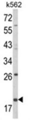 Killer Cell Lectin Like Receptor D1 antibody, AP18089PU-N, Origene, Western Blot image 