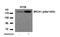 BRCA1 DNA Repair Associated antibody, GTX38676, GeneTex, Western Blot image 