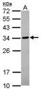 Tubulin Polyglutamylase Complex Subunit 2 antibody, PA5-31682, Invitrogen Antibodies, Western Blot image 