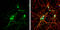 Somatostatin Receptor 3 antibody, GTX130114, GeneTex, Immunocytochemistry image 