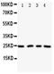Nucleophosmin/Nucleoplasmin 2 antibody, PA1991, Boster Biological Technology, Western Blot image 